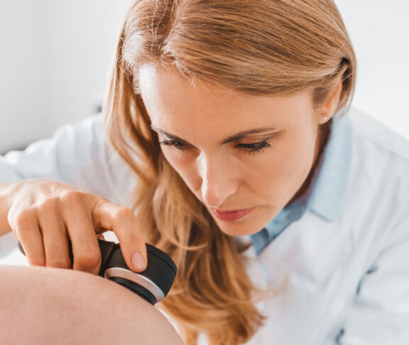 Doctor dermatologist examines skin of patient. Dermatoscopy, prevention of melanoma, skin cancer.