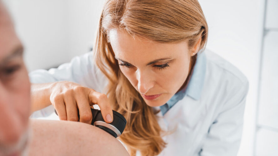 Doctor dermatologist examines skin of patient. Dermatoscopy, prevention of melanoma, skin cancer.