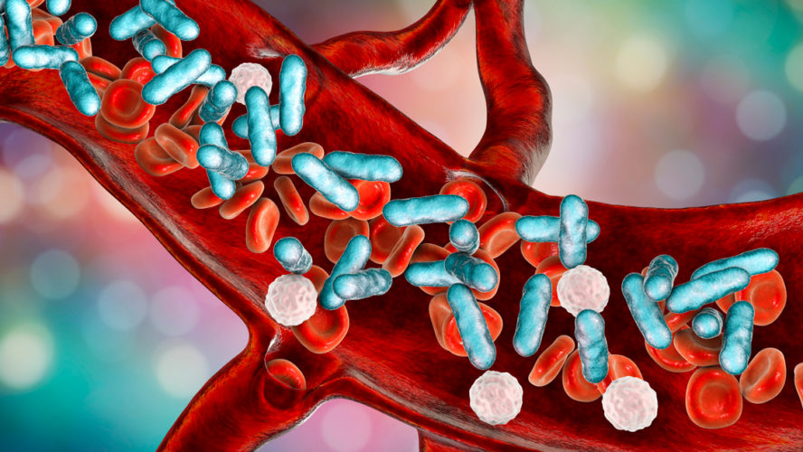 Sepsis, bacteria in blood. 3D illustration showing rod-shaped bacteria with red blood cells and leukocytes