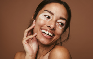 Woman with skin pigmentation