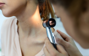 Doctor dermatologist examines skin of patient. Dermatoscopy, prevention of melanoma, skin cancer