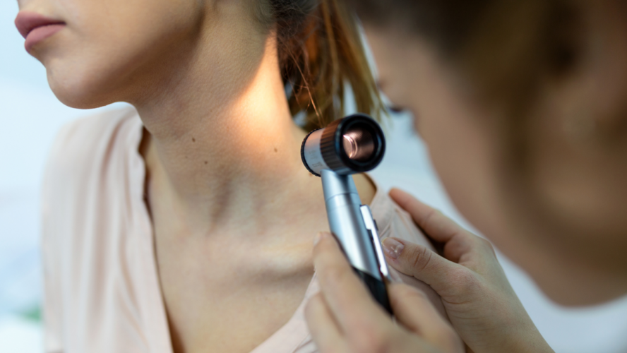 Doctor dermatologist examines skin of patient. Dermatoscopy, prevention of melanoma, skin cancer